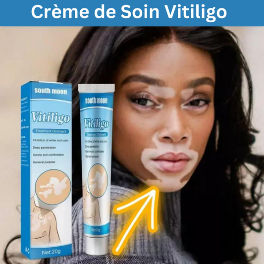 Crème de Soin Vitiligo